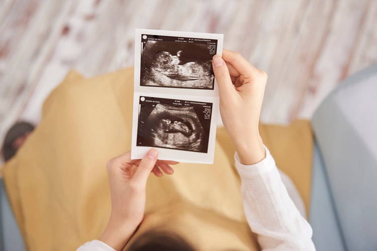 妊婦健診のイメージ画像